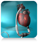 LVAD program, transplant hospital